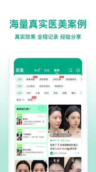 新氧极速版