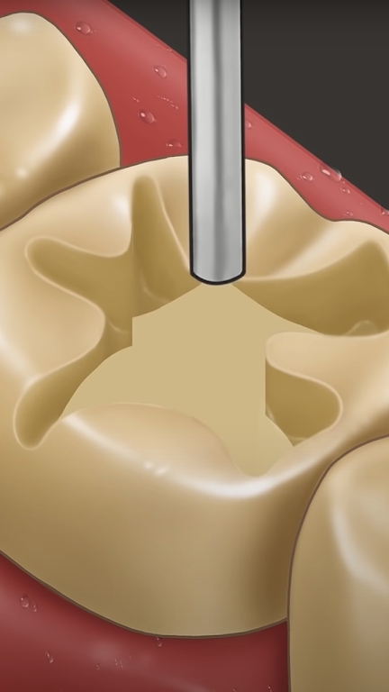 Dentist Master(牙医硕士)