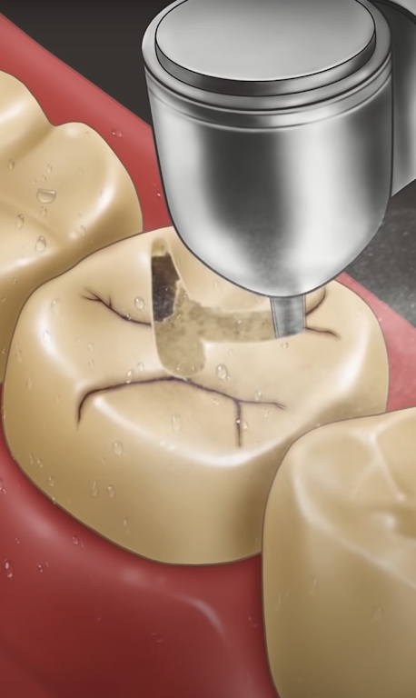 Dentist Master(牙医硕士)
